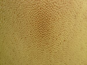 開き毛穴とたるみ毛穴の違いは何ですか？